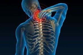 Neck pain caused by cervical bone and chondropathy