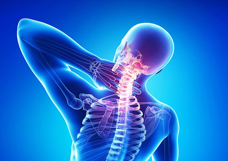 Spinal osteochondrosis is a disease that affects joint cartilage and vertebrae.