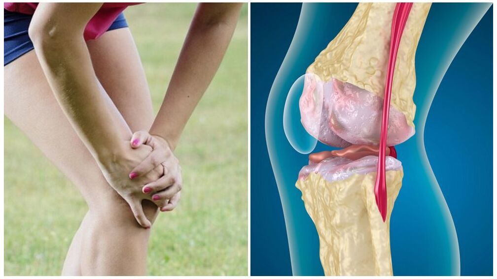 Symptoms of Arthropathy